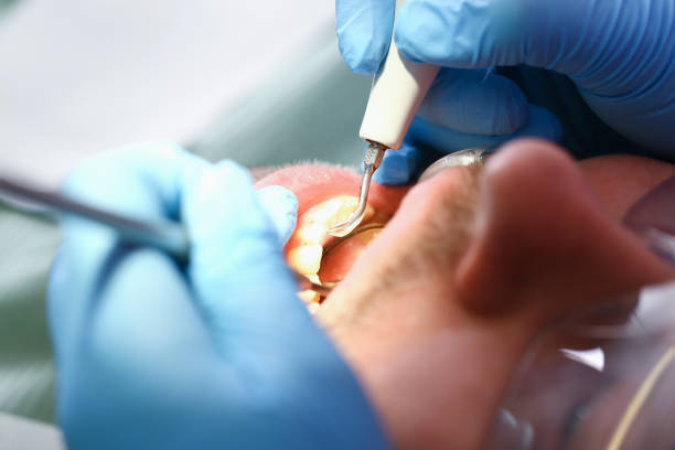 Best Emergency Treatment for Toothache in Flence, OR